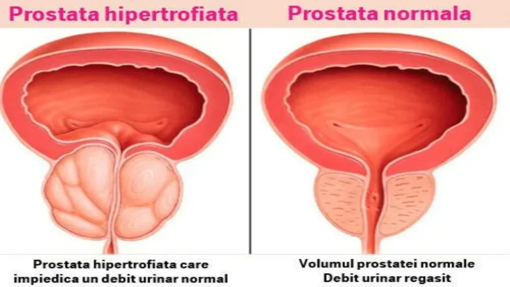 užívání - funguje - složení - akce - dávkování - jak používat - co to je